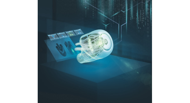 Courtesy: Siemens
