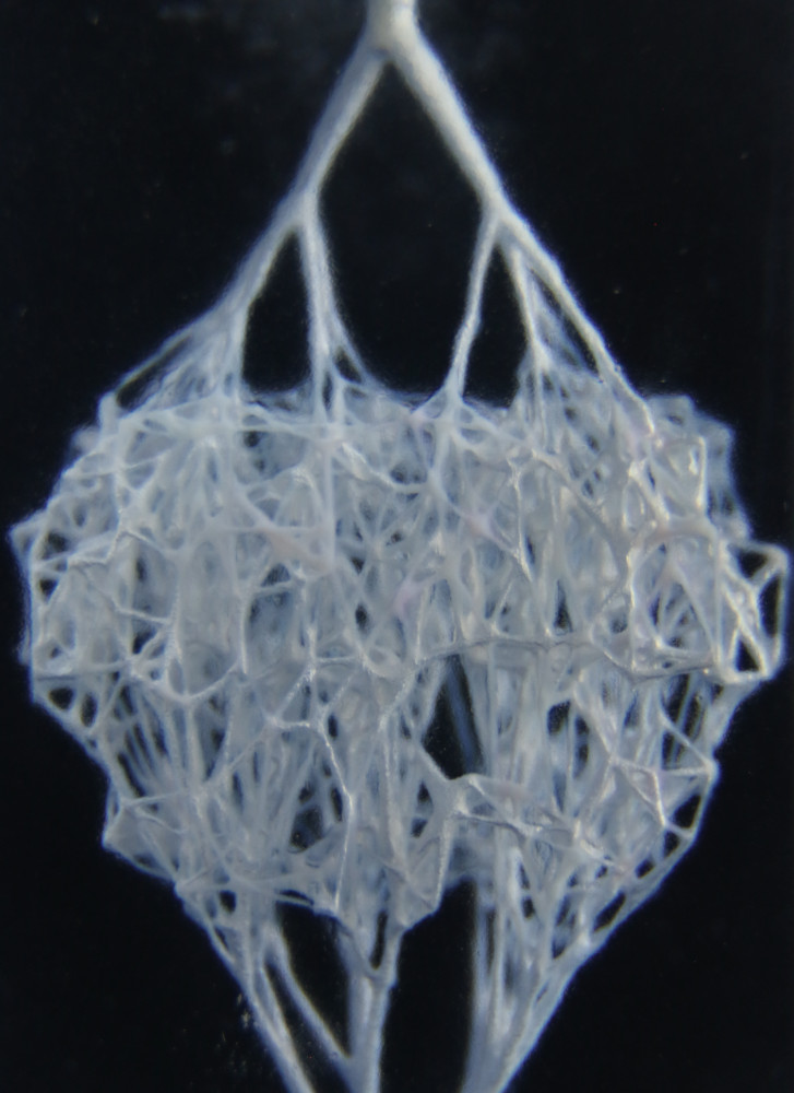 A network of capillaries 3D-printed using a newly developed technique. Courtesy: University of Colorado-Boulder