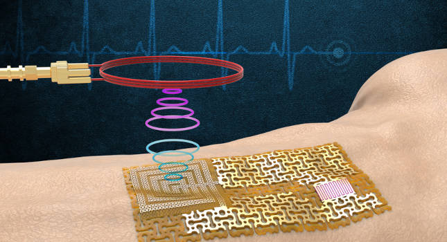 wearable sensors