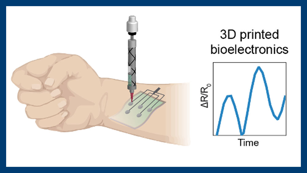 Researchers at the Gaharwar Laboratory have developed a new nanoengineered bioink for 3D-printable wearable bioelectronics. These 3D-printable devices are electronically active and can monitor dynamic human motion, paving the way for continuous motion monitoring. Courtesy of: Gaharwar Laboratory
